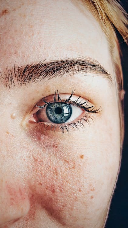 Woman applying eye drops for dry eye treatment in Mill Creek, WA